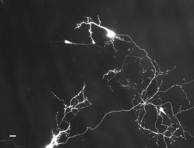 Figure 1: Primary Hippocampal Neurons expressing GFP