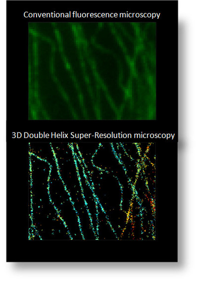 Superresolution image of microtubule structure of mamalian cells