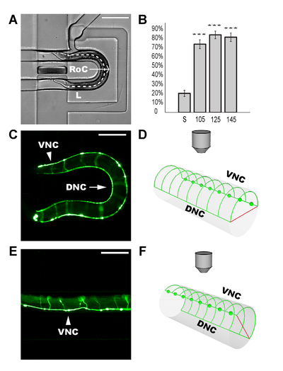 Positioning and orienting C. Elegans for high throughput neuronal screening