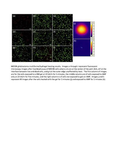 Images showing how hydrogel nanocomposites can kill cancer cells